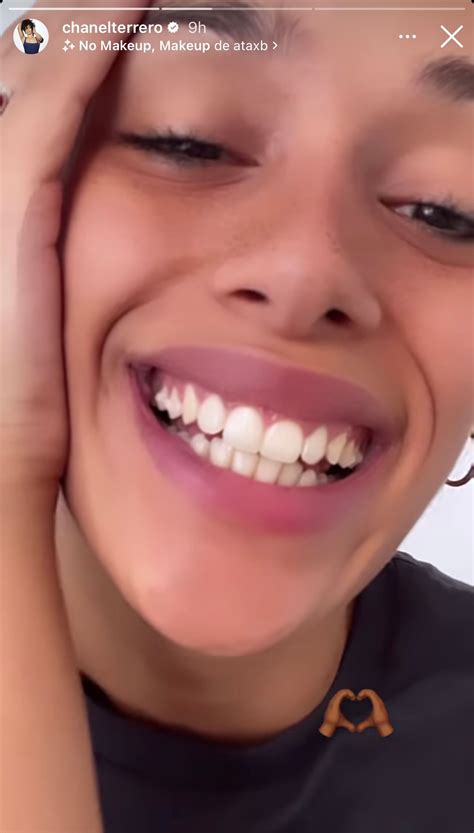 dientes chanel